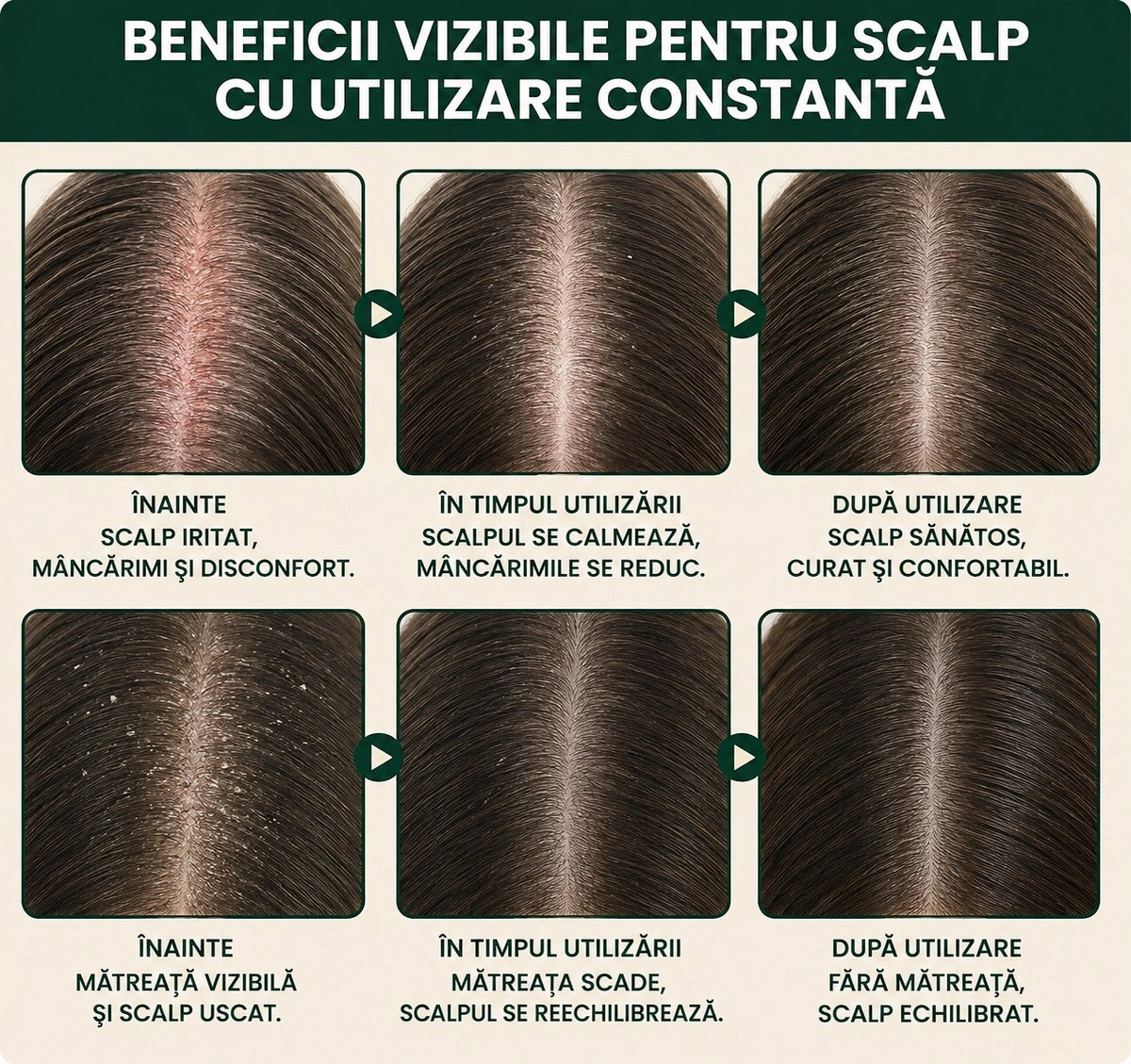 Șampon solid natural pentru scalp iritat – Reduce iritația, disconfortul, senzația de scalp gras și mâncărimea.