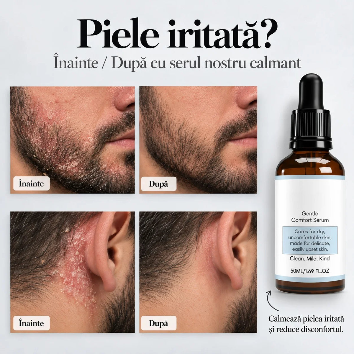 Ser natural pentru calmarea pielii iritate – Reduce roșeața, mâncărimile, descuamarea și senzația de disconfort a pielii.