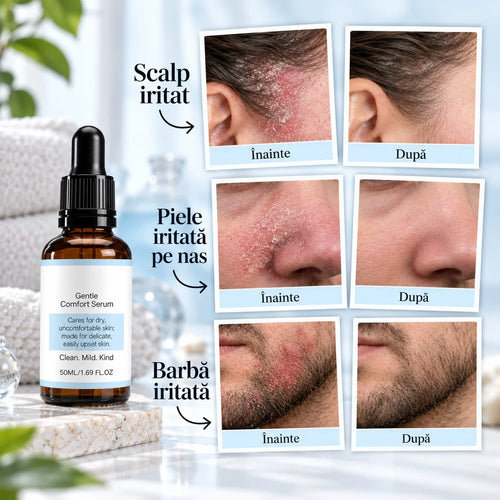 Ser natural pentru calmarea pielii iritate – Reduce roșeața, mâncărimile, descuamarea și senzația de disconfort a pielii.